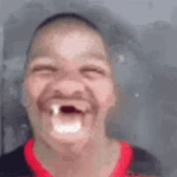 meme hài gốc sún răng